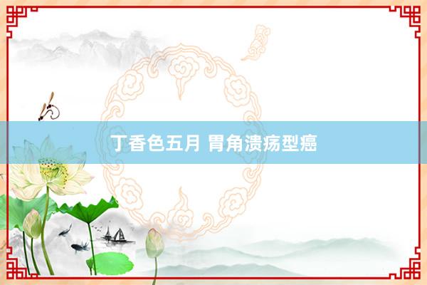 丁香色五月 胃角溃疡型癌